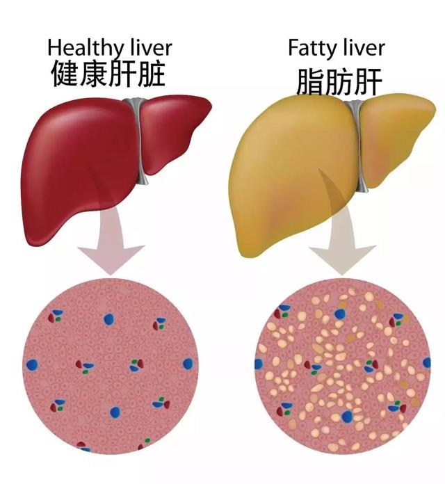 清淡饮食等于吃素？别太天真了，这4点才是清淡饮食的标准