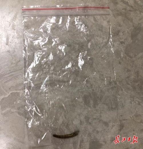 鱼刺|小伙鱼刺卡喉吞饭2天后卡住“出口”，鱼刺卡喉后，最好连水都别喝