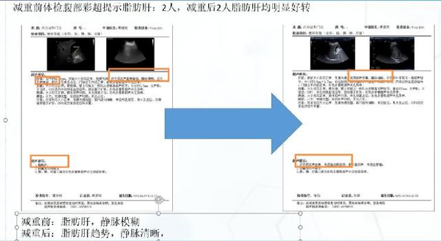 如何科学减肥？专家告诉你“肌”不可失