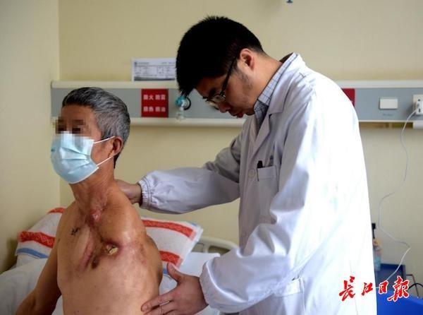 爹爹|“励志爹”18年经历16次手术：“只要能活着，多痛我都忍！”