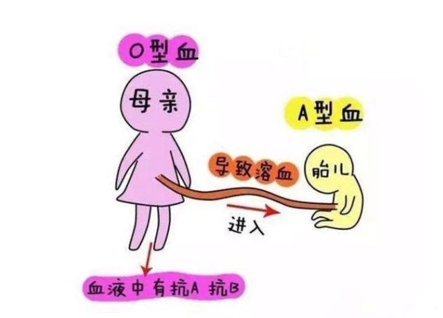 【超级宝妈】这3个产检项目已被叫停，孕妈多了解，千万不要别坑了！