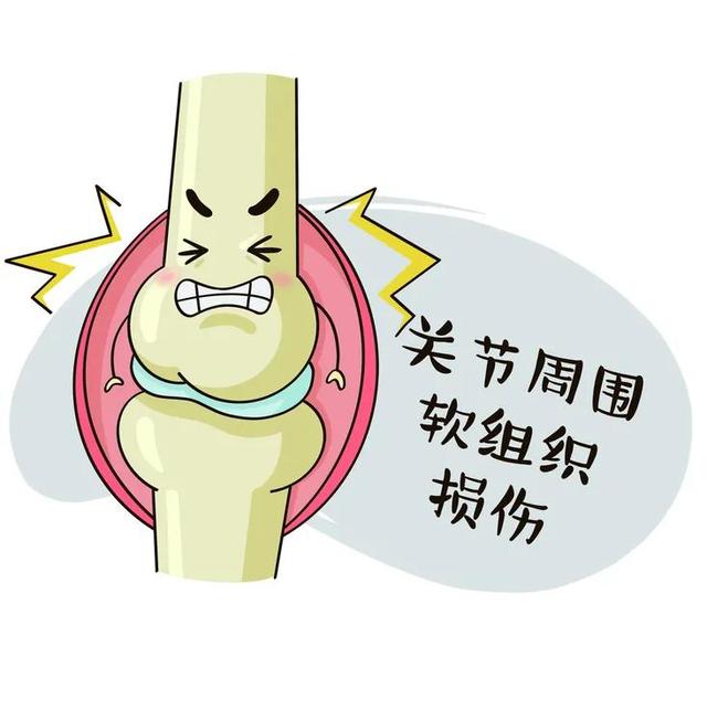 11个折磨你关节的重要因素，“内外因”大剖析