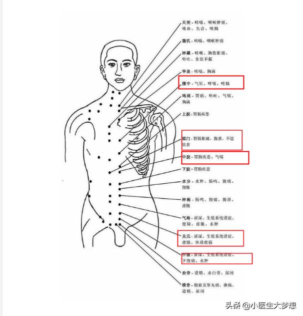 实践技能针灸常用90个腧穴位置图