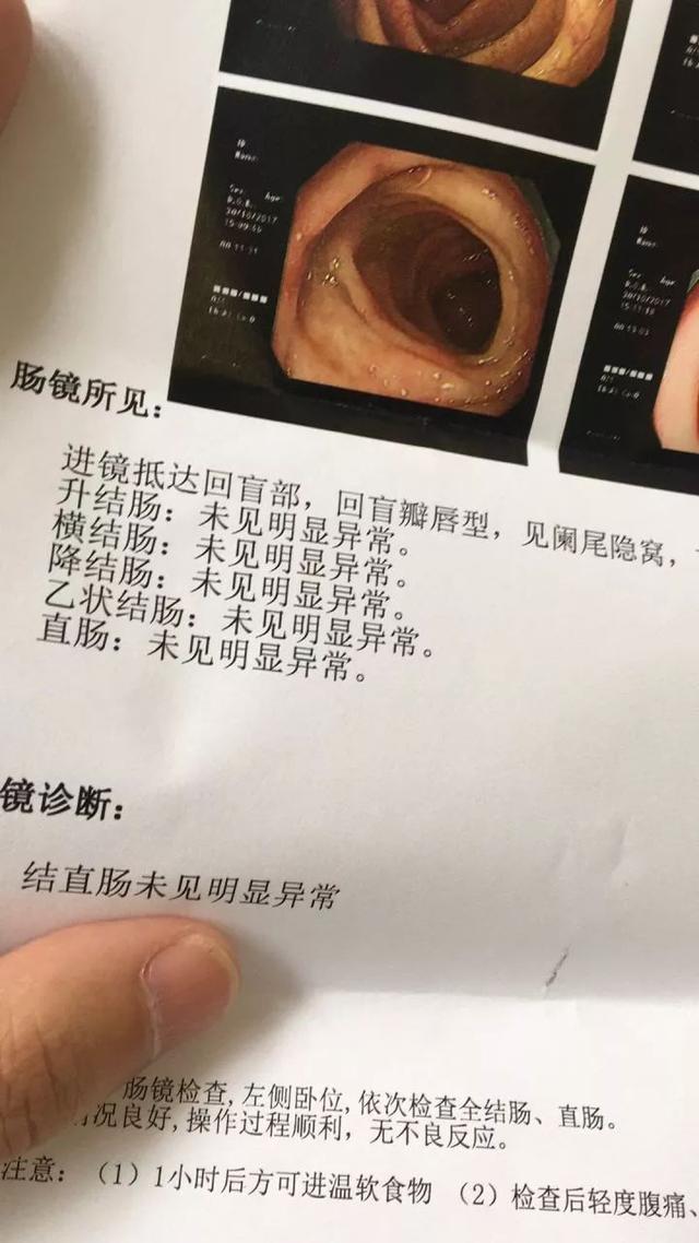 肠镜检查到底是什么体验？检查前怎么准备肠道？