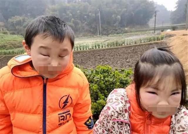 你的育儿经■熊孩子兄妹误捅马蜂窝，脸肿得爹妈不敢认，网友：不该笑但忍不住