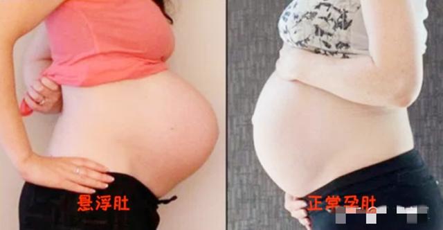 「你的育儿经」为什么“悬浮肚”的产妇不能顺产？两大难关难突破，还有尴尬等候