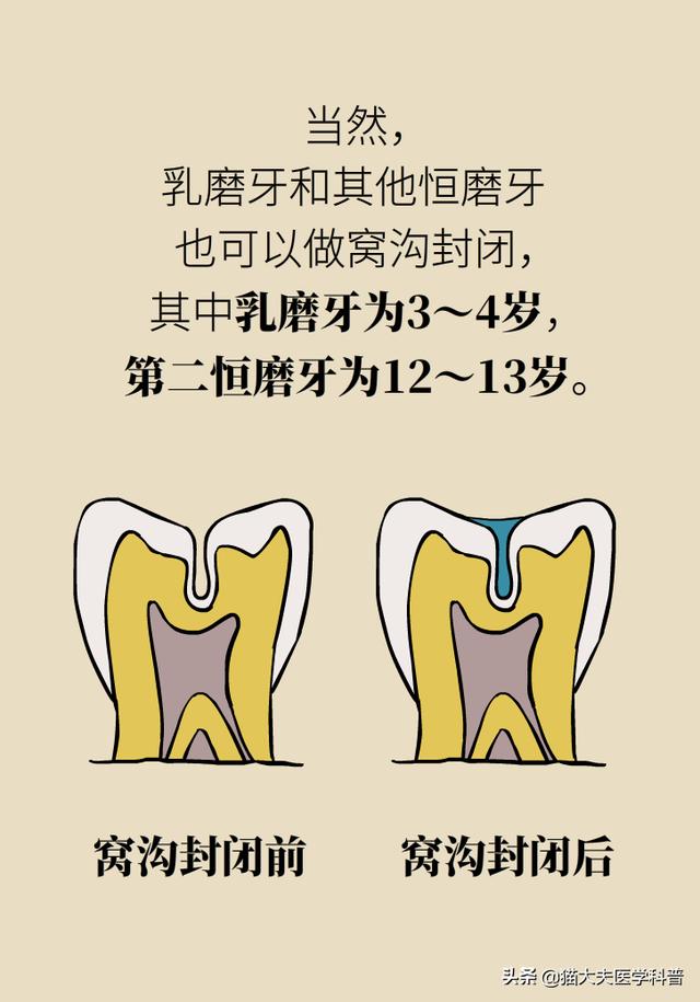 长虫牙不用管，反正要换牙？要是这样想可害了娃儿了