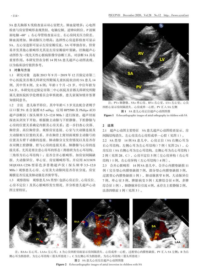 14 例单心房患儿超声心动图表现