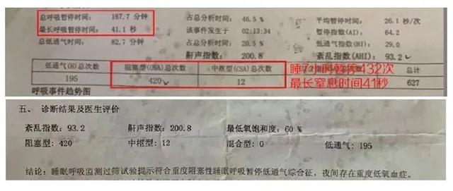 呼吸|打呼噜是睡的香吗？一男子睡着呼噜作响，竟“断气”432次