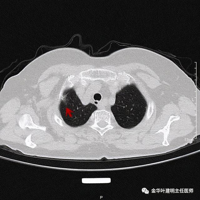 如此违反原则的手术方案设计，你支持吗？