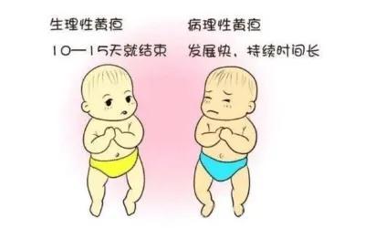 [你的育儿经]新生儿黄疸是怎么回事？