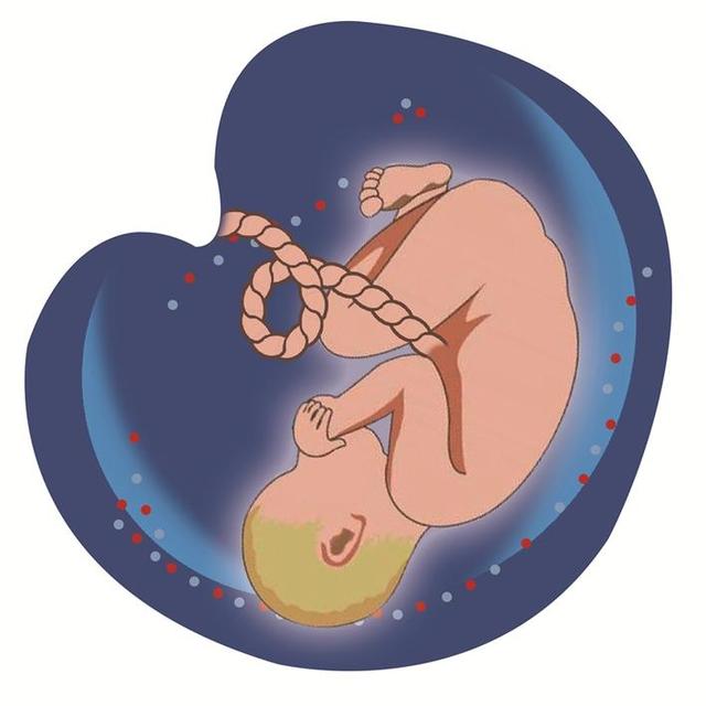 脐带扭转45圈 8个月胎宝命悬一“带”