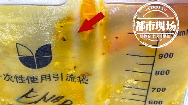 寄生虫|男子体内发现很多寄生虫，医生：和饮食习惯有关