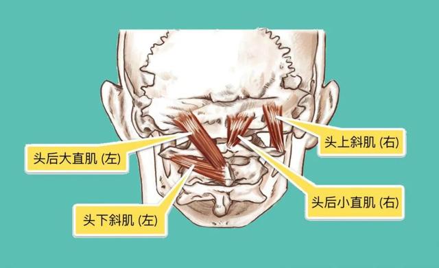 神奇的枕下肌群，是颈肩痛的关键？如何松解？