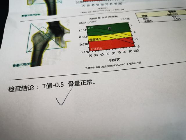 医生分享真实病例，细数防治更年期骨质疏松的诸多细节，请您查收