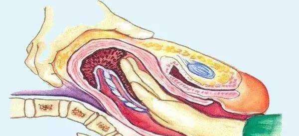 「超级宝妈」“剖腹产就算再差，我也坚持”，看完顺产3D过程，才明白为母则刚