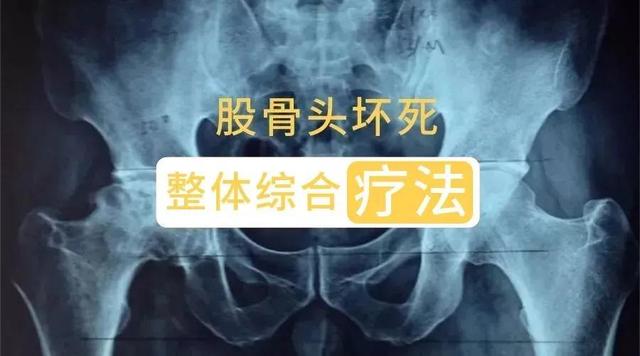 「主任分享」保髋患者不用过分关心片子，自己功能改善才是重点