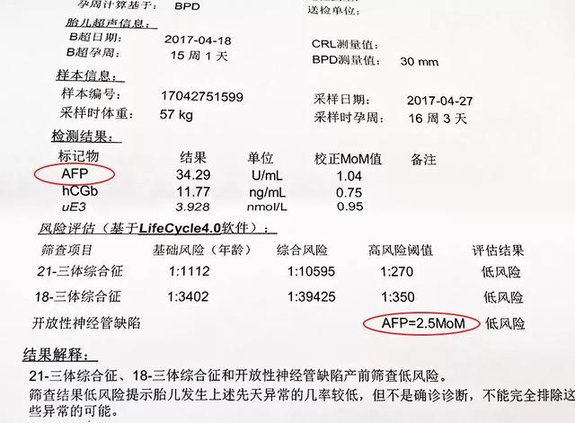避风港|唐筛必须要做吗?什么时间做唐筛?唐筛要注意哪些事项?