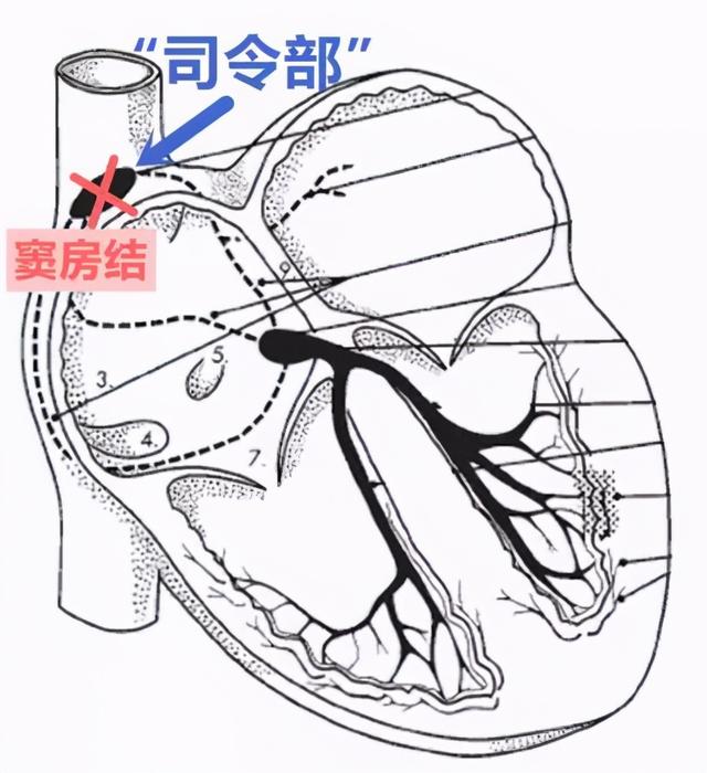 心跳慢到底要不要紧？