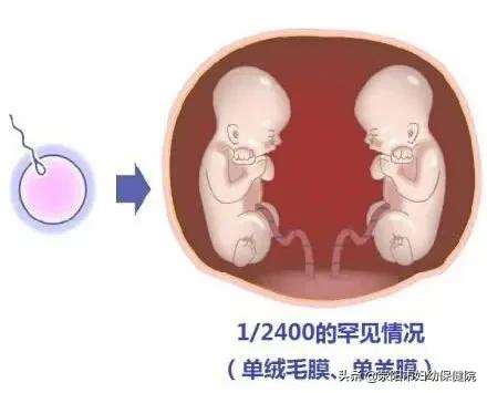 「你的育儿经」“争地盘”，从妈妈肚子里开始