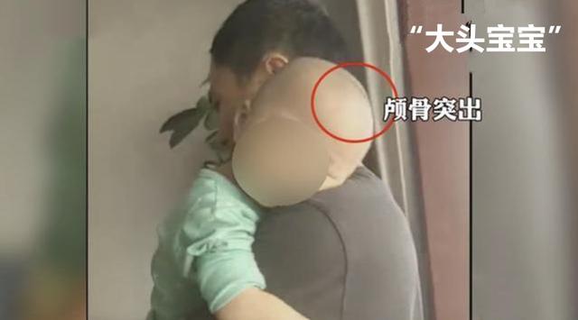 【超级宝妈】商家居然将固体饮料当奶粉卖，致多名幼儿喝成“大头娃娃”
