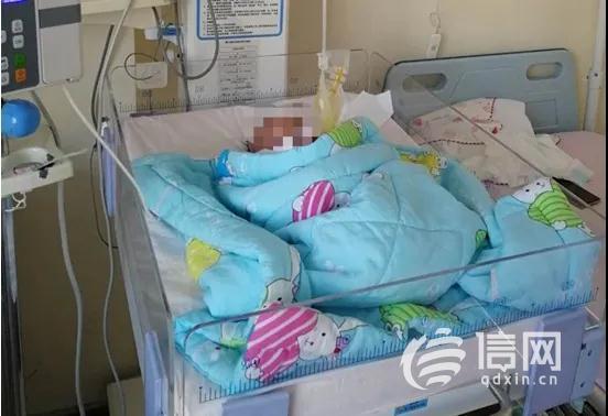 你的育儿经▲妇儿医院“产前产后一体化”诊疗 脐膨出患儿成功获救