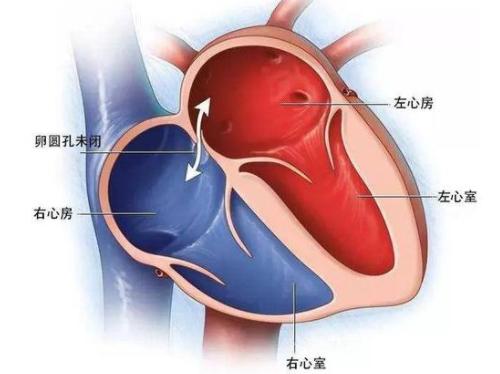 57岁大妈肾、肺、脑血管堵塞，居然是“心眼”出问题了？