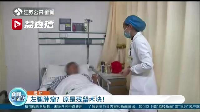 男子发现左腿里有大肿块，担心是“肿瘤”一查是残留了40年的木块