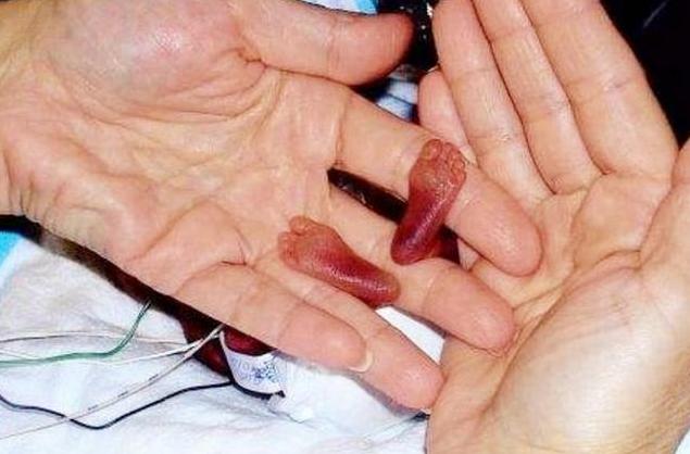 「超级宝妈」全世界最小的“婴儿”，仅和圆珠笔一样大，网友：简直是个奇迹