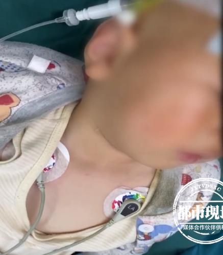 『超级宝妈』1岁多男童又哭又喘，喉咙取出的东西，妈妈都震惊了！