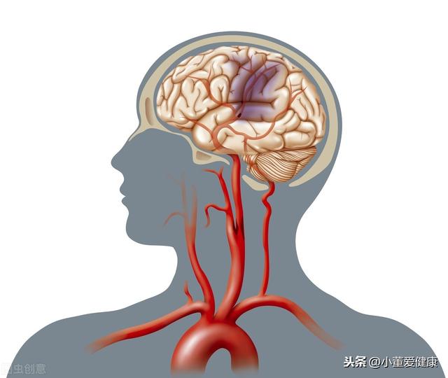 嘴歪眼斜？不一定是得了脑血栓，这一类患者很难恢复