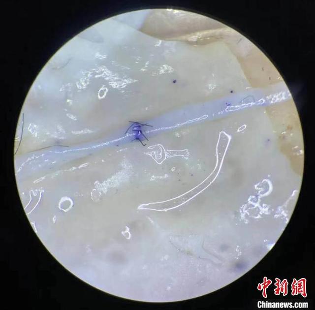 外科|专注“毫米功夫”：外科医生用生鸡翅练习缝合技术