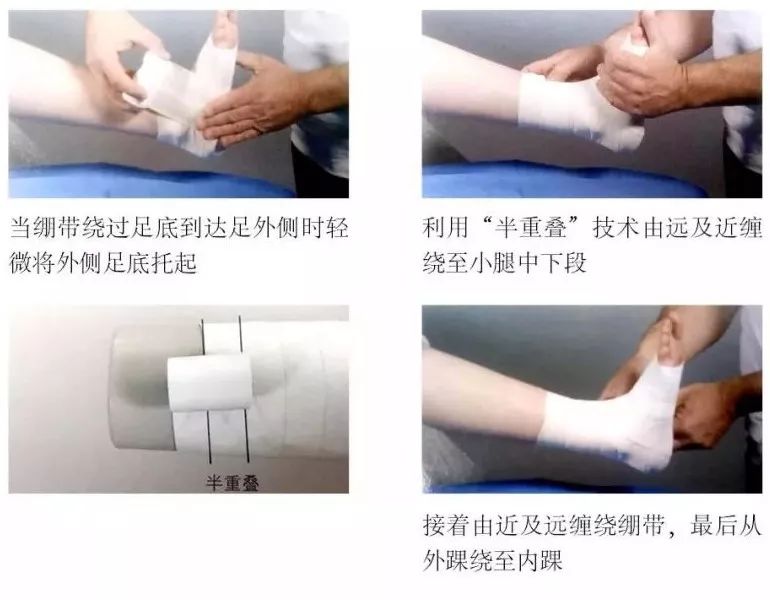 6种绷带固定法,轻松应对各部位骨折!