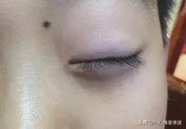 #超级宝妈#小儿推拿李波：孩子脾胃好不好？除了看舌苔眼袋颜色也能帮你判断
