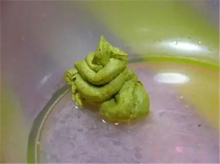 「暖先生格调」宝宝拉绿便就是奶粉的“锅”？饥饿、辅食......这些都可能，附图干货拿去！