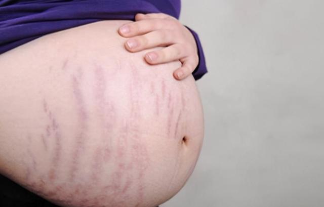 吉娜孕7月又晒身材，被吐槽过度营销，网友：别再误导孕妇形象