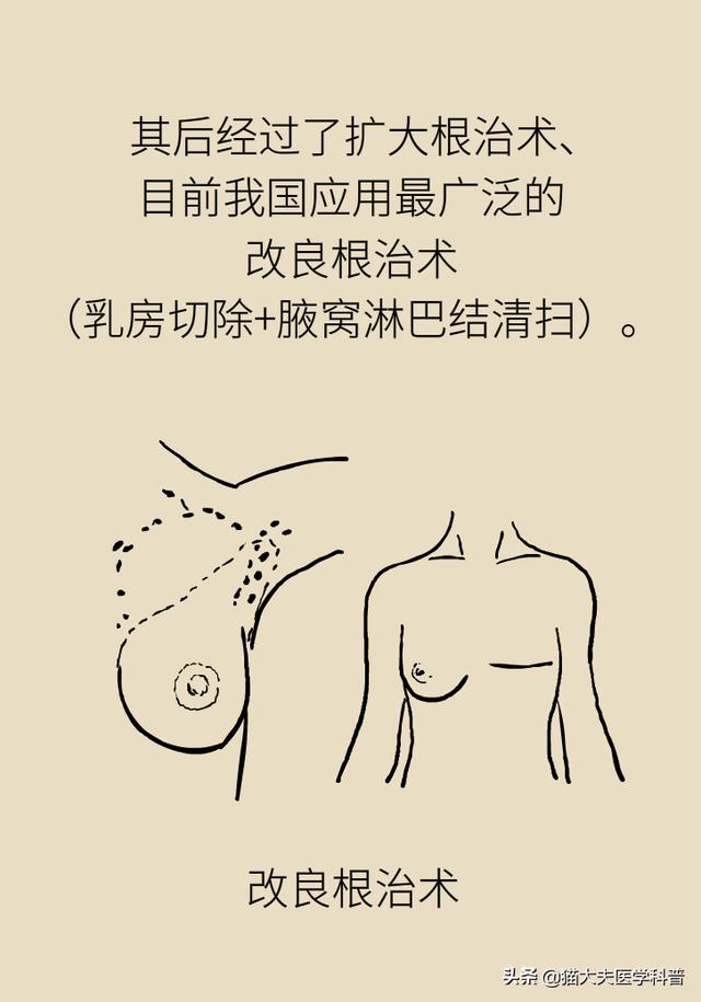 医生，能不能别切掉我的乳房？