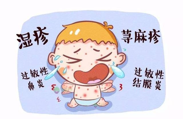 『你的育儿经』@咸阳人注意!别把过敏不当回事儿