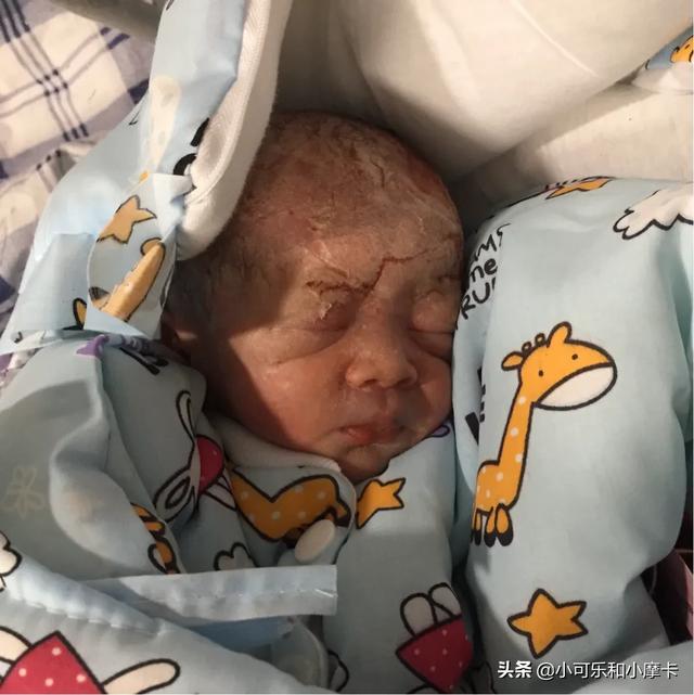 超级宝妈@早产的双胞胎兄弟，如何从干瘪小老头，逆袭为两个胖嘟嘟的小肉球