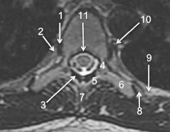 ռ׵ MRI ͼ