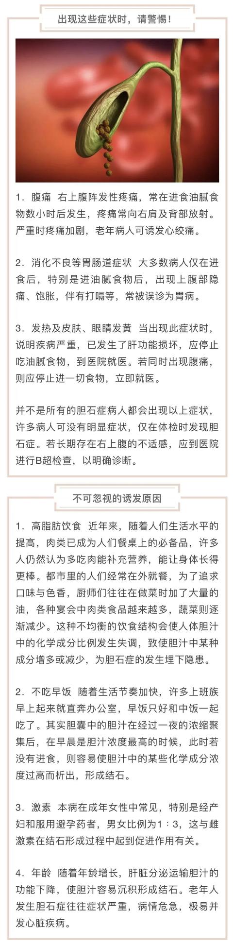 发病率|胆结石病“重女轻男”，有了这些表现时您得警惕啦