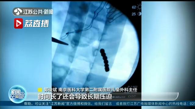 【超级宝妈】祸从口入！3岁男童吞了41颗磁力珠 医生紧急手术救命