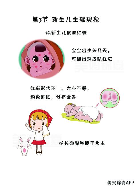 你的育儿经|新生儿皮肤红斑怎么办?