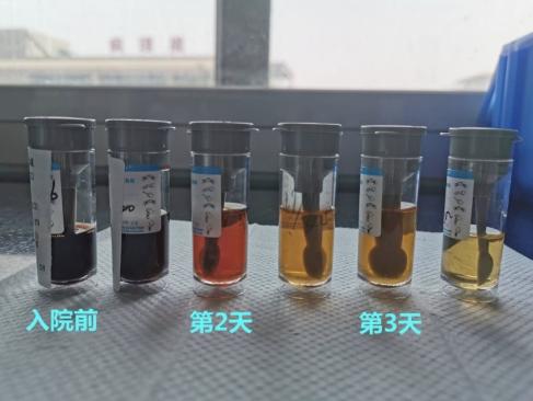 [你的育儿经]差点没命！孩子高烧，爸妈在家“自诊”……这几种情况，一定要去医院