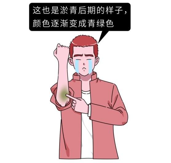 女生的膝盖总是有淤青，背后的原因是什么？为什么男生很少有？