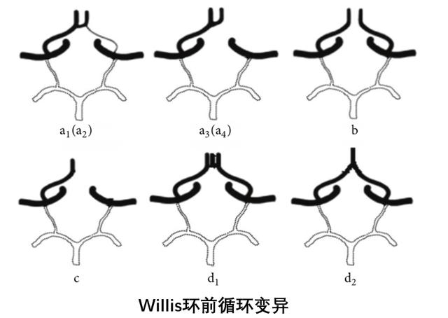 脑内的Willis环，你知道吗？