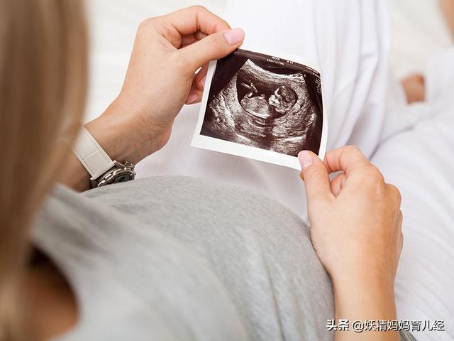 [你的育儿经]生男生女真的有预兆吗？孕妇体征预测男女的方法，这个方法挺靠谱