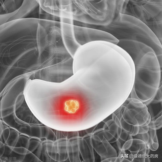 饮食过于重口味，会患胃癌吗