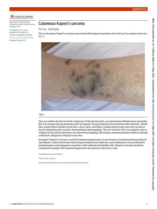 患者|皮肌炎患者用药后全身多处出现紫黑色结节，上海医生查明病因