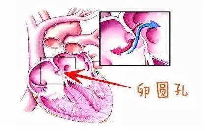 57岁大妈肾、肺、脑血管堵塞，居然是“心眼”出问题了？